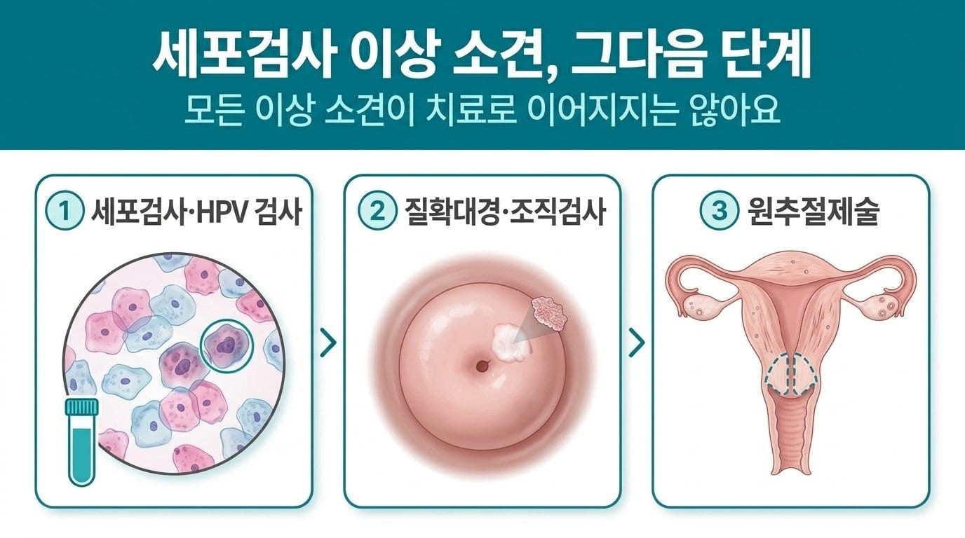 세포검사 이상 소견 뒤 HPV 검사, 질확대경·조직검사, 원추절제술로 이어지는 단계와 단계마다 갈림길이 있다는 점을 정리한 자료화면